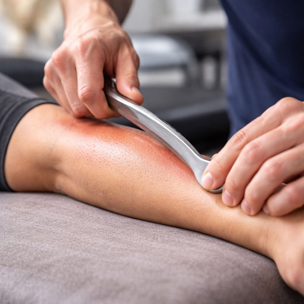 Doctor doing Muscle Scraping on patient at Bodle Chiropractic and Integrative Health