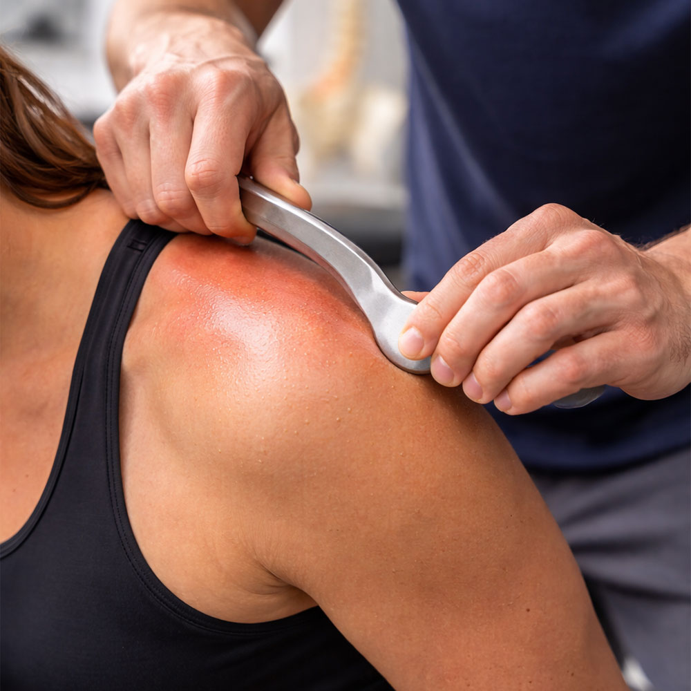 Patient Receiving Muscle Scraping